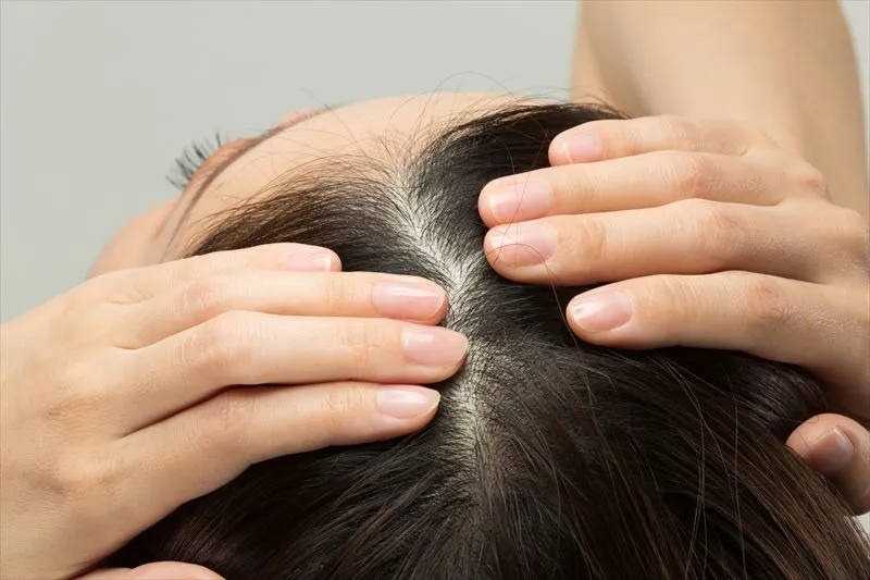 頭皮におけるにおいの原因